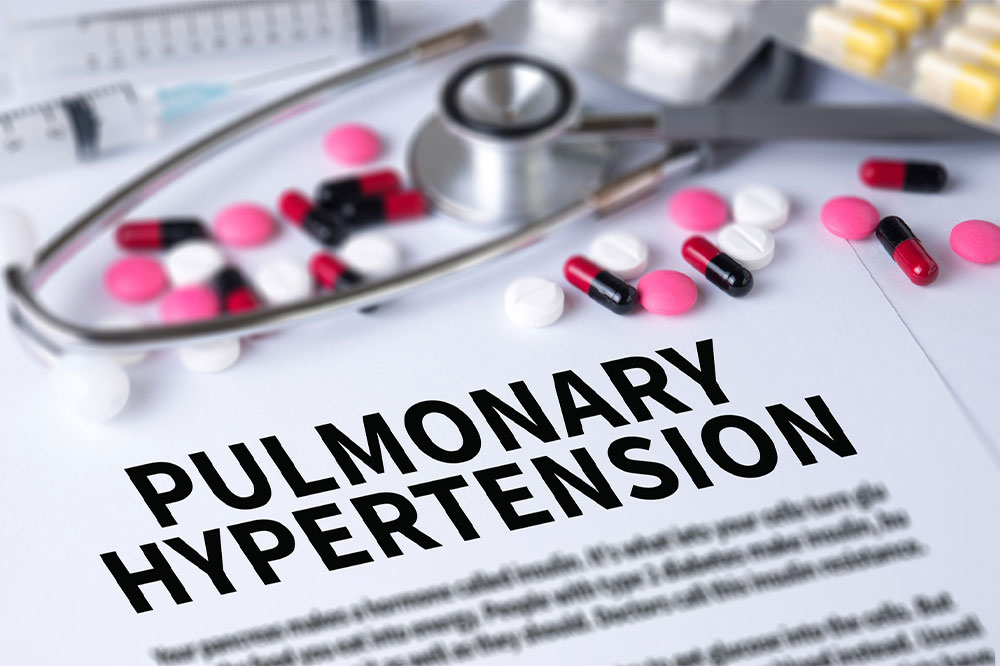 Common Causes and Risk Factors of Pulmonary Arterial Hypertension