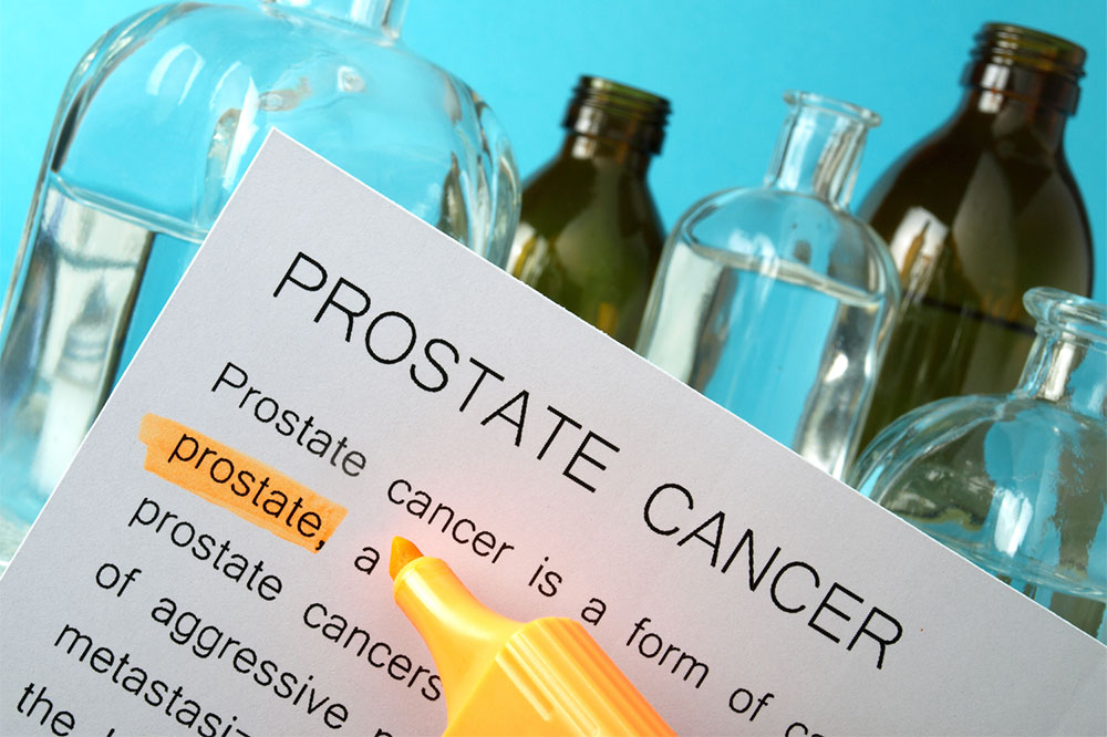 The Link Between Vitamin D Deficiency and Prostate Cancer