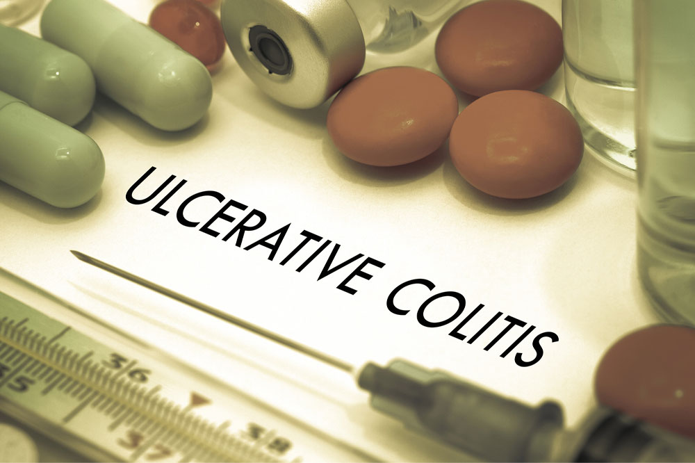 Ulcerative Colitis – Risk Factors and Warning Signs